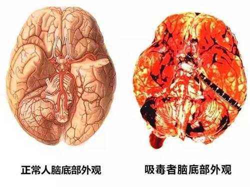 冰毒的危害是不可逆的吗 毒品相关知识 上海凯创生物技术有限公司