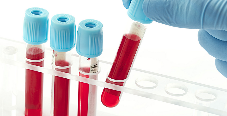 hCG外周血滋养细胞检测
