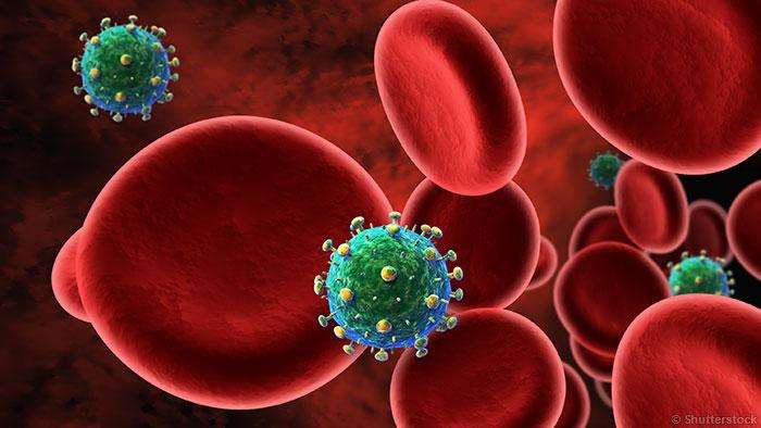 州国王县四名男子身上发现一种前所未见的人类免疫缺陷病毒(hiv)