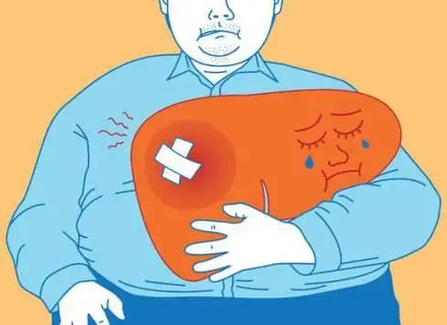 丙型肝炎对三大人群的危害预防与治疗